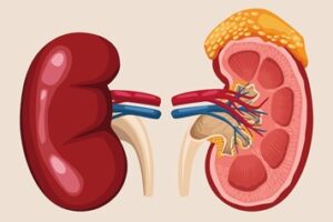 Understanding Glomerulonephritis