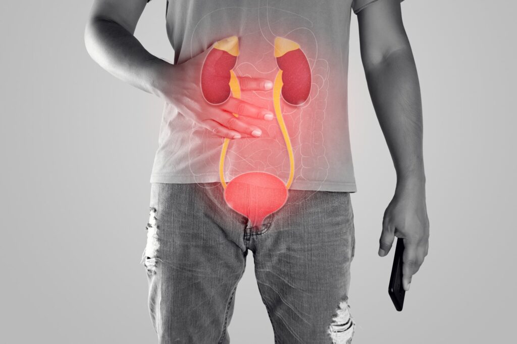 You are currently viewing Understanding Nephrotic Syndrome: Causes, Symptoms, and Treatment
